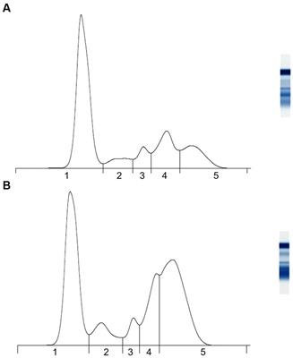 Non-specific markers of inflammation in bare-nosed wombats (Vombatus ursinus) with sarcoptic mange